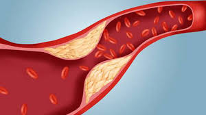 Giảm hàm lượng cholesterol là lợi ích của quả roi