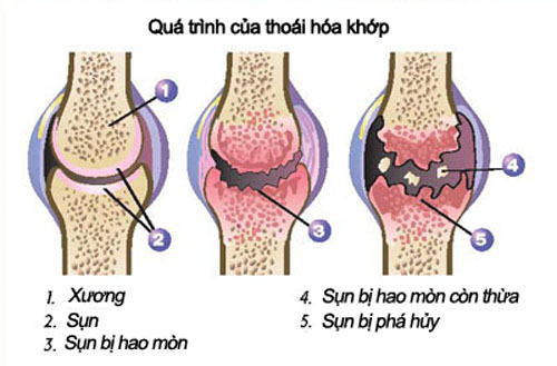 bi-quyet-an-uong-phong-ngua-thoai-hoa-khop-1