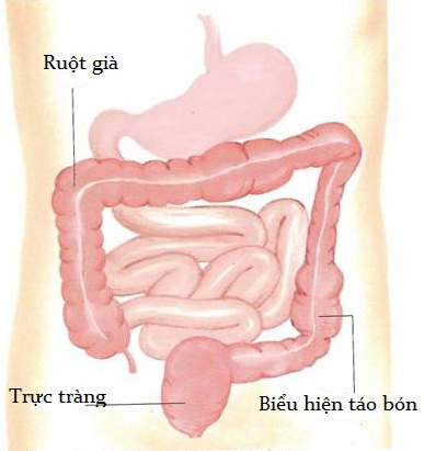 khong-tu-y-dung-thuoc-tri-tao-bon-1