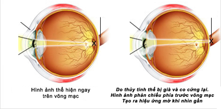 lao-thi-su-dung-kinh-the-nao-cho-dung-1