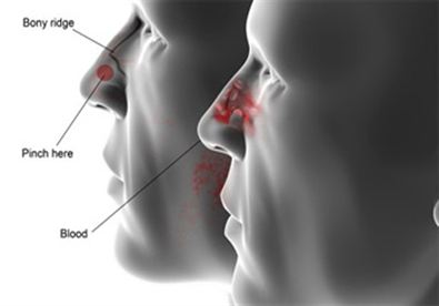 Giúp bạn Bài thuốc hiệu quả trị bệnh đầu đông