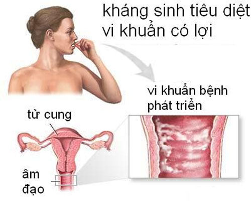 Giúp bạn Những điều cần lưu ý sau chu kì kinh nguyệt