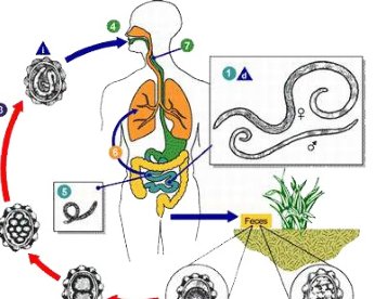 Giúp bạn Thuốc trị bệnh do ký sinh trùng đường ruột