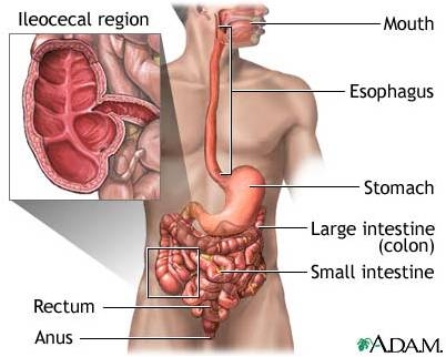 Giúp bạn Bệnh Crohn: Nguyên nhân, yếu tố nguy cơ