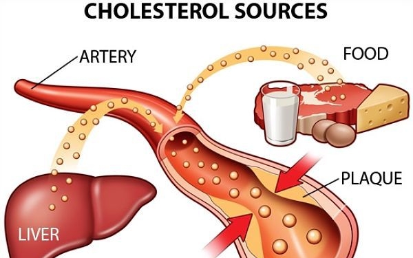 Giúp bạn Bệnh mỡ máu cao (cao cholesterol)