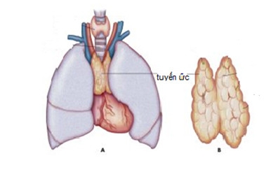 Giúp bạn Bệnh nhược cơ là gì?