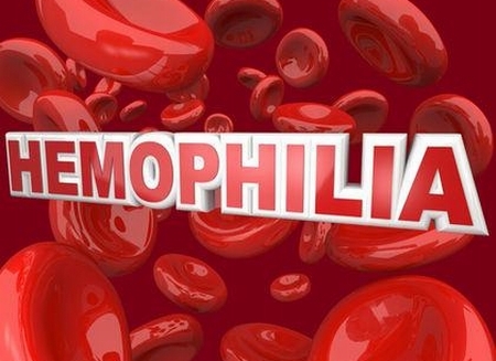 Giúp bạn Bệnh rối loạn đông máu di truyền Hemophilia ở trẻ em