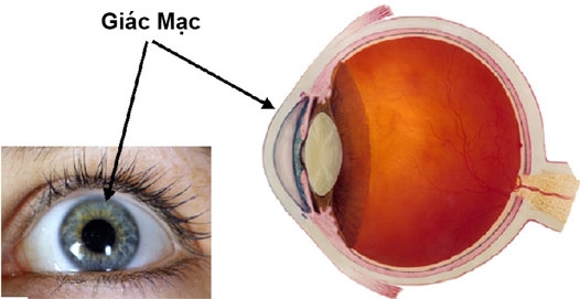Giúp bạn Bệnh viêm loét giác mạc