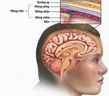 Giúp bạn Bệnh viêm não