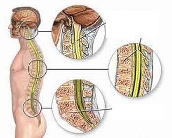 Giúp bạn Bị liệt từ ngực trở xuống do rơi từ trên cao điều trị thế nào?