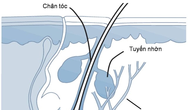 Giúp bạn Điều trị viêm chân tóc