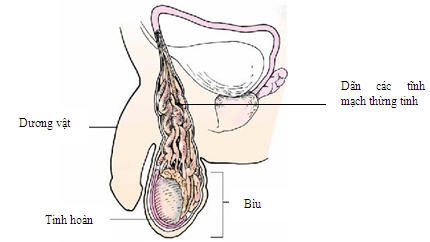 Giúp bạn Giãn tĩnh mạch thừng tinh