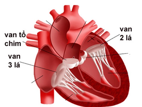 Giúp bạn Hở van ba lá