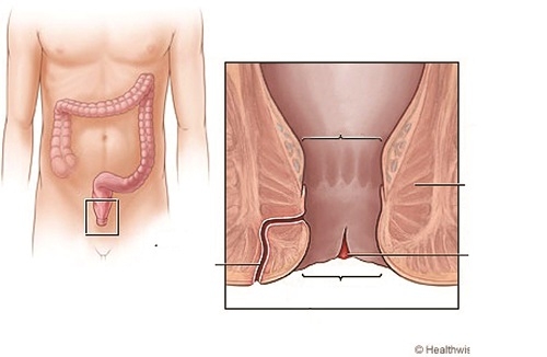 Giúp bạn Nứt kẽ hậu môn: Nguyên nhân, triệu chứng