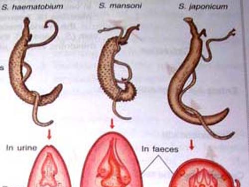 Giúp bạn Phương pháp chẩn đoán và phòng ngừa nhiễm sán máng