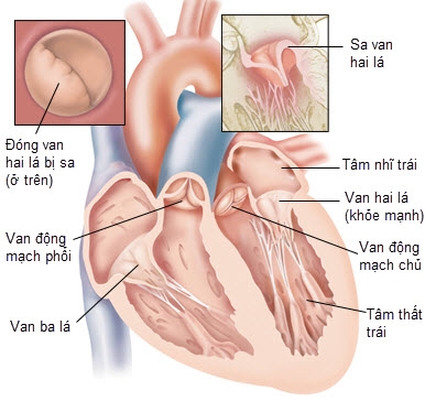 Giúp bạn Sa van hai lá