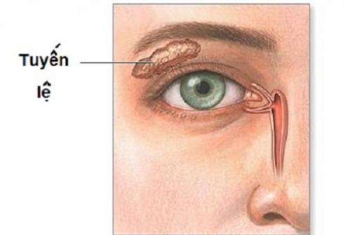 Giúp bạn Tắc tuyến lệ