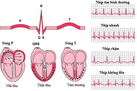 Giúp bạn Triệu chứng rối loạn nhịp tim