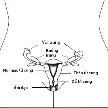 Giúp bạn Ung thư nội mạc tử cung: Những điều cần biết