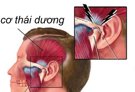 Giúp bạn Viêm khớp thái dương hàm