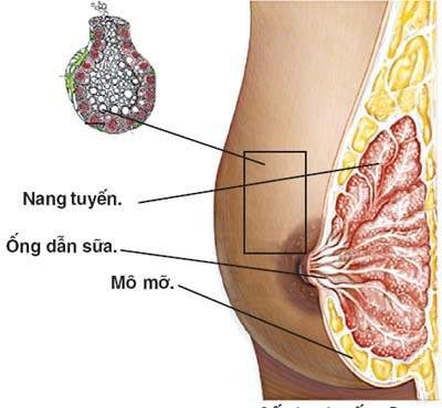 Giúp bạn Viêm tuyến vú sau sinh