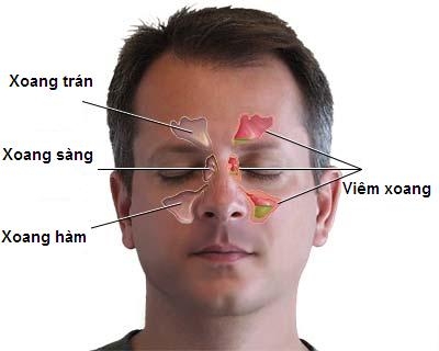 Giúp bạn Viêm xoang hàm: Nguyên nhân, triệu chứng